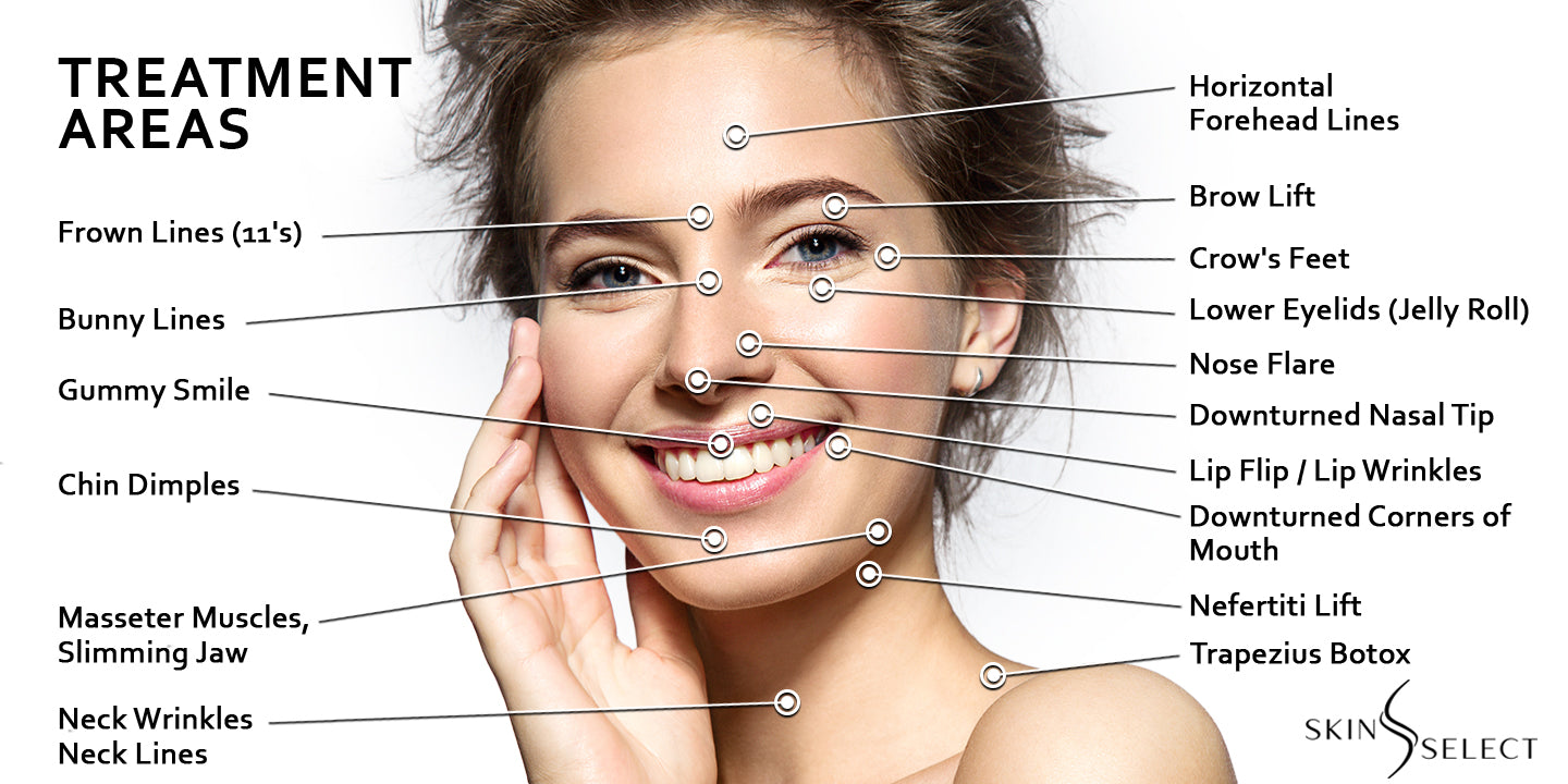 files/Botox_Treatment_Areas.jpg