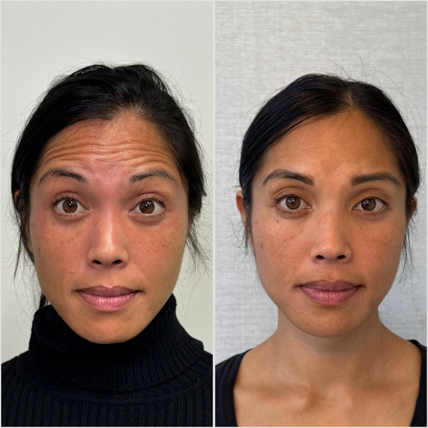 files/Before_after_1_1b10bf18-3847-4616-86c2-332e7e462986.jpg