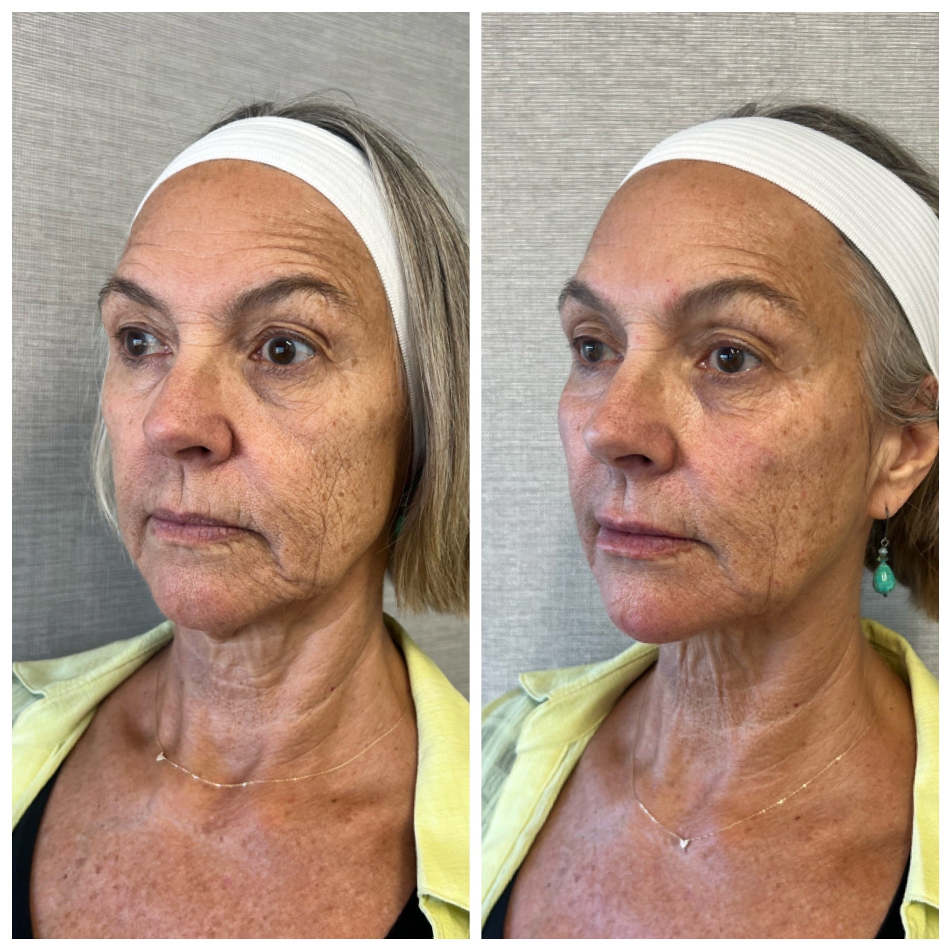 files/Patient_3_4f9dd66f-dacc-4b80-8ea1-fab5f39cddbf.jpg
