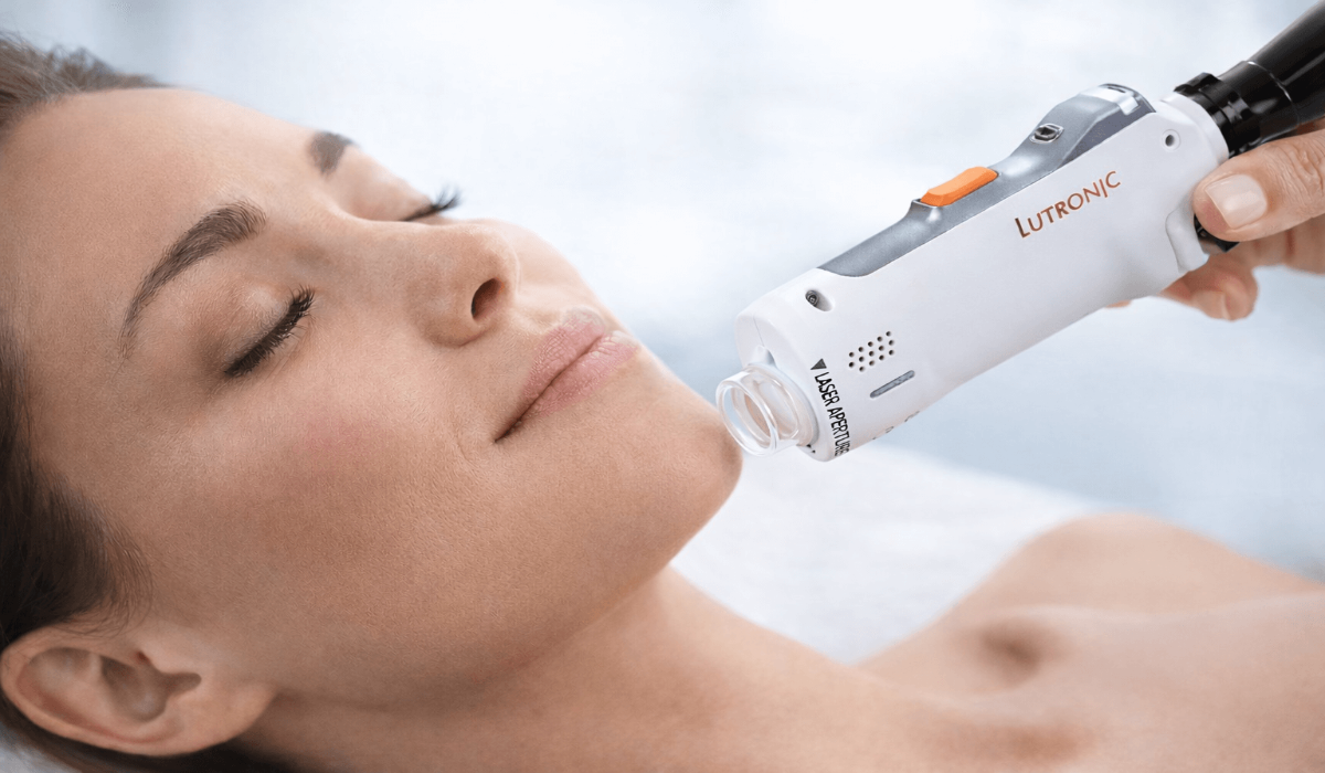 DermaV Laser Treatment