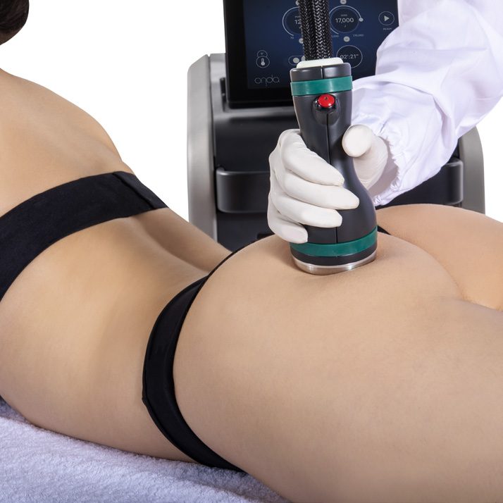 How Onda Pro Coolwaves body contouring works