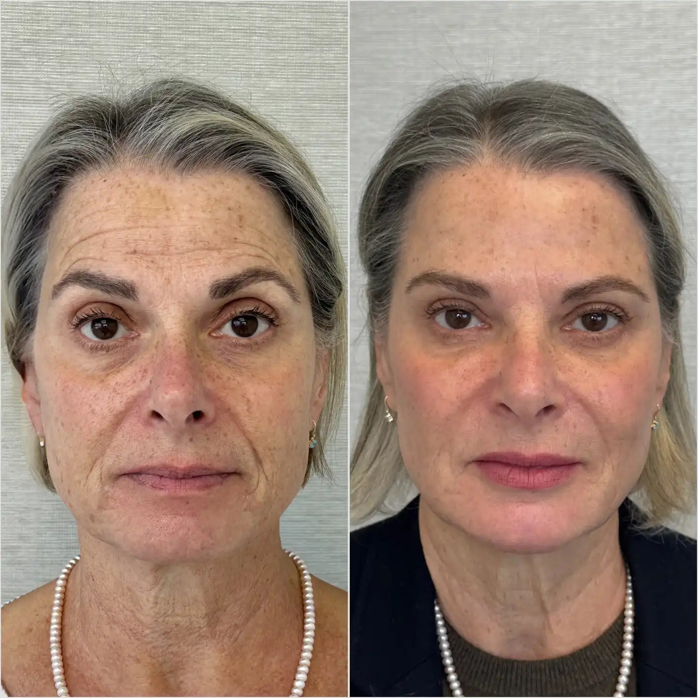 files/skinselect_face.webp